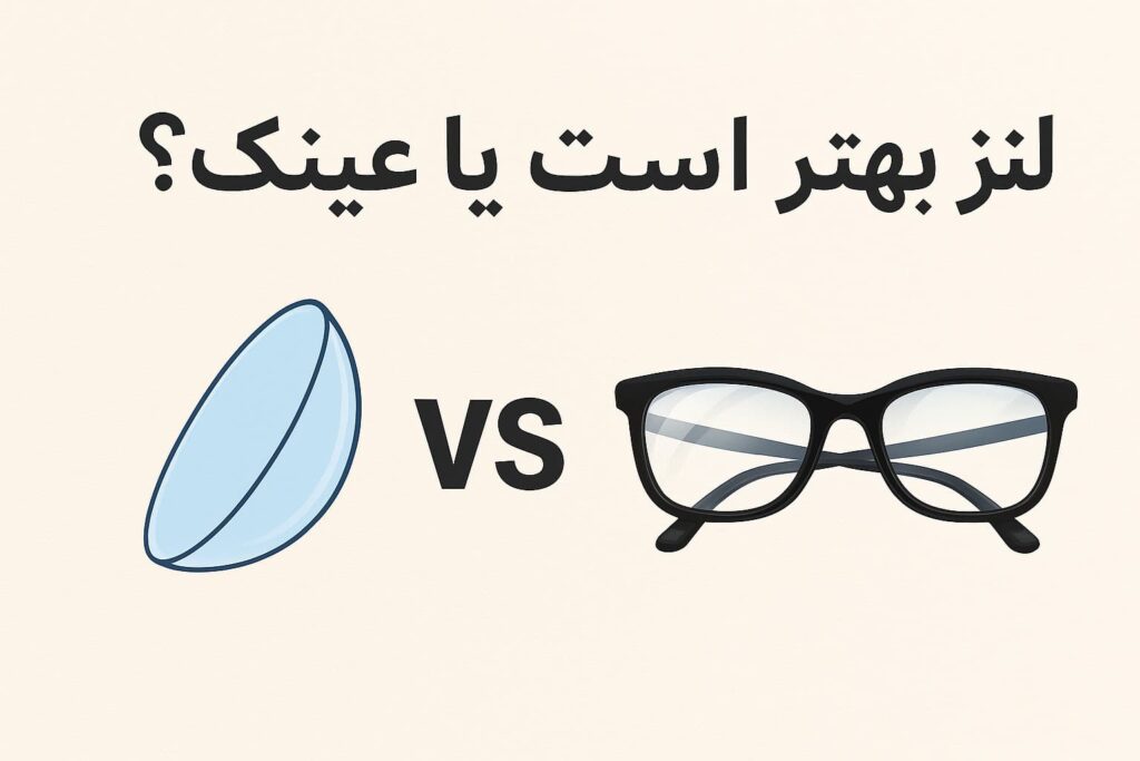 بهترین عینک فروشی مشهد